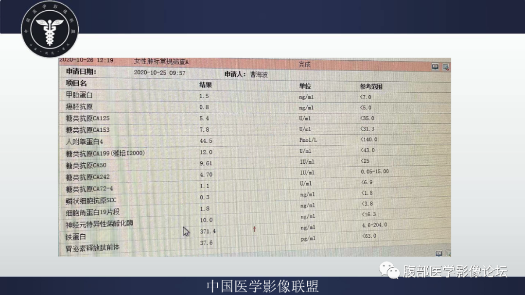 影像PPT - 【病例】腹膜后副神经节瘤1例CT影像-3