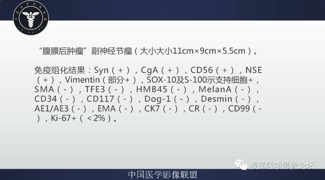 影像PPT - 【病例】腹膜后副神经节瘤1例CT影像-9
