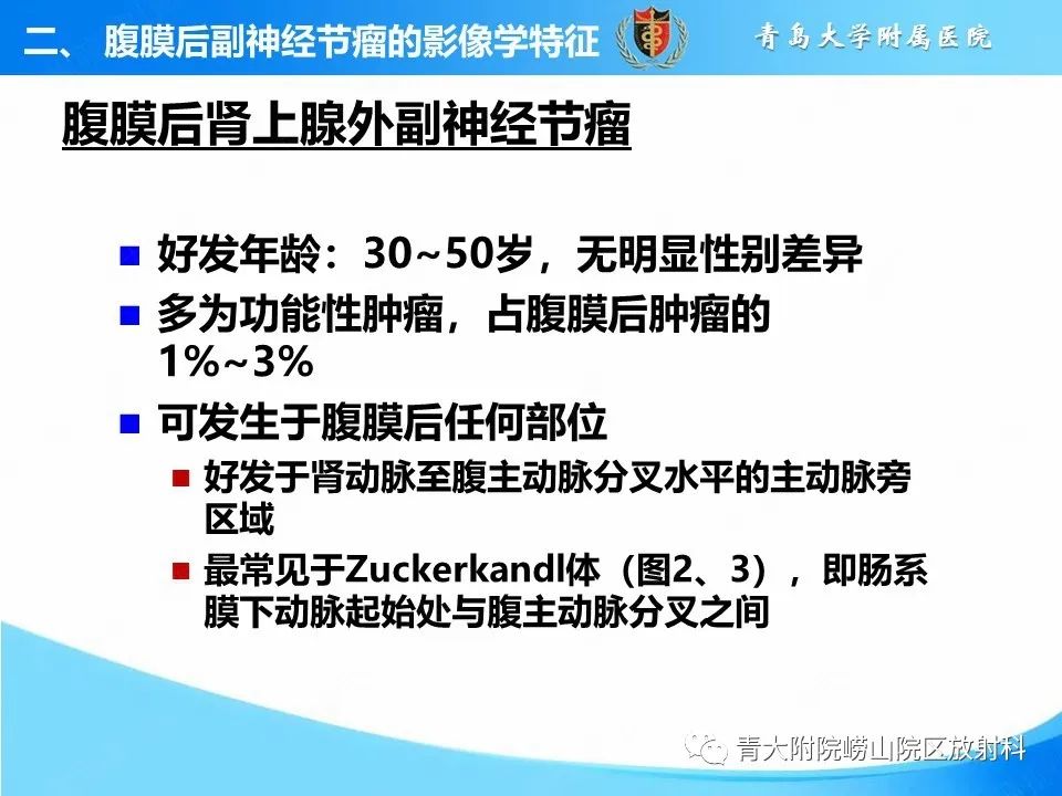 影像PPT - 【病例】腹膜后副神经节瘤1例CT影像-23