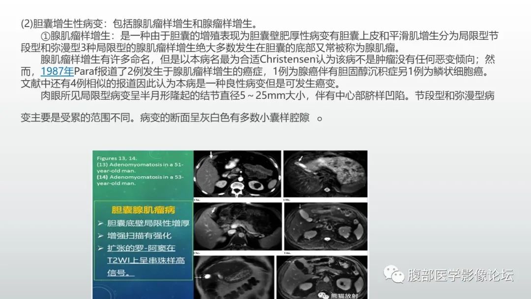 影像PPT - 【病例】胆囊管状腺瘤1例CT及MR影像表现-19