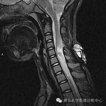 影像PPT - \ 影像PPT - \