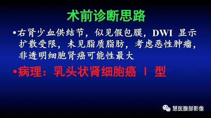 影像PPT - 【PPT】肾脏短T2局灶病变MRI表现与鉴别诊断思路-9