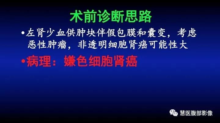 影像PPT - 【PPT】肾脏短T2局灶病变MRI表现与鉴别诊断思路-19