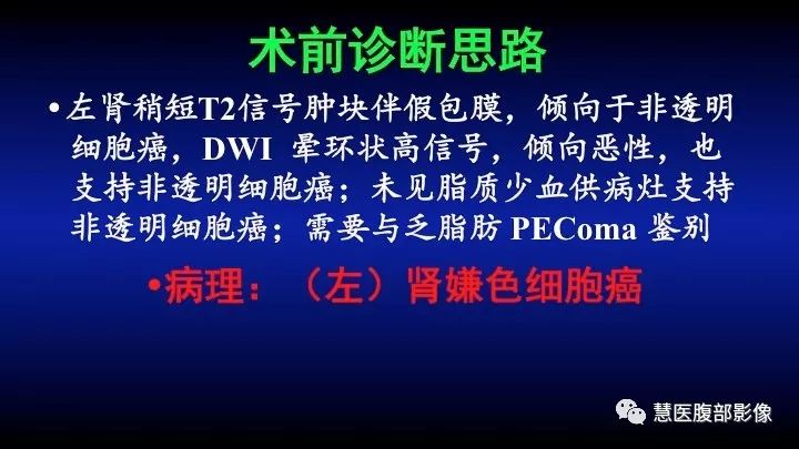 影像PPT - 【PPT】肾脏短T2局灶病变MRI表现与鉴别诊断思路-24