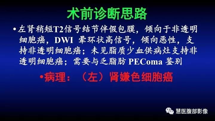影像PPT - 【PPT】肾脏短T2局灶病变MRI表现与鉴别诊断思路-29