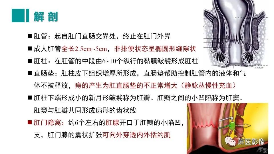 影像PPT - 【PPT】肛管及肛周区域病变MRI影像特征-9
