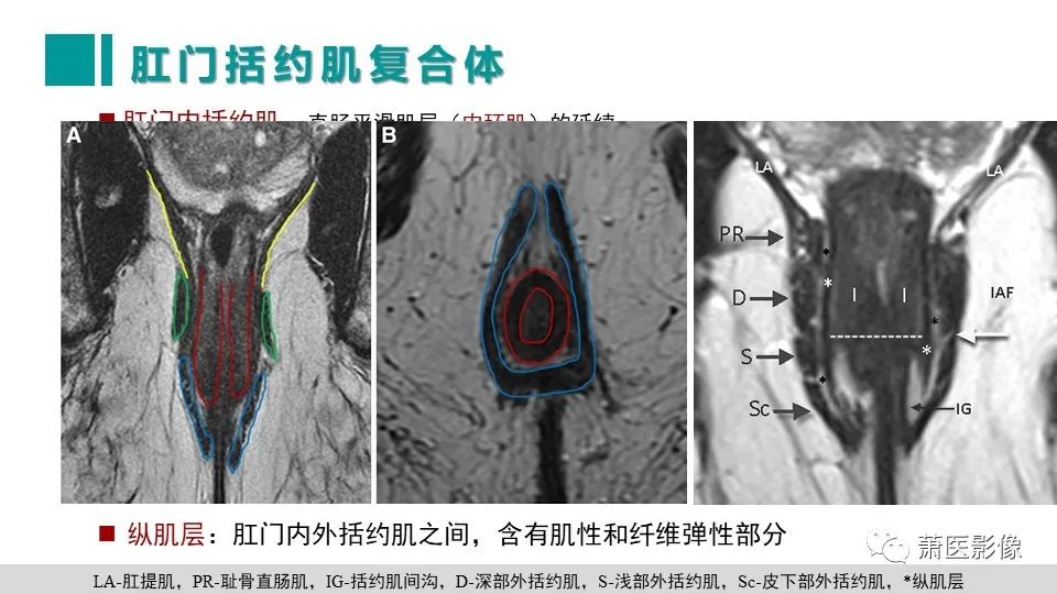 影像PPT - 【PPT】肛管及肛周区域病变MRI影像特征-12