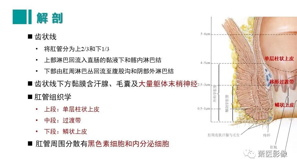 影像PPT - 【PPT】肛管及肛周区域病变MRI影像特征-11