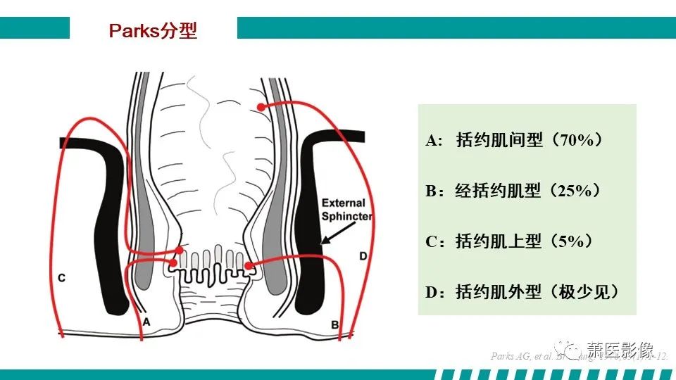 影像PPT - 【PPT】肛管及肛周区域病变MRI影像特征-23