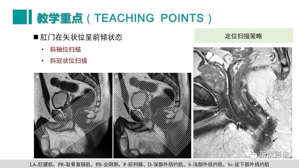 影像PPT - 【PPT】肛管及肛周区域病变MRI影像特征-52