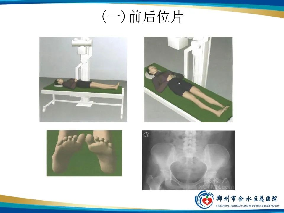 影像PPT - 【PPT】骨盆拍片技术与临床意义-7