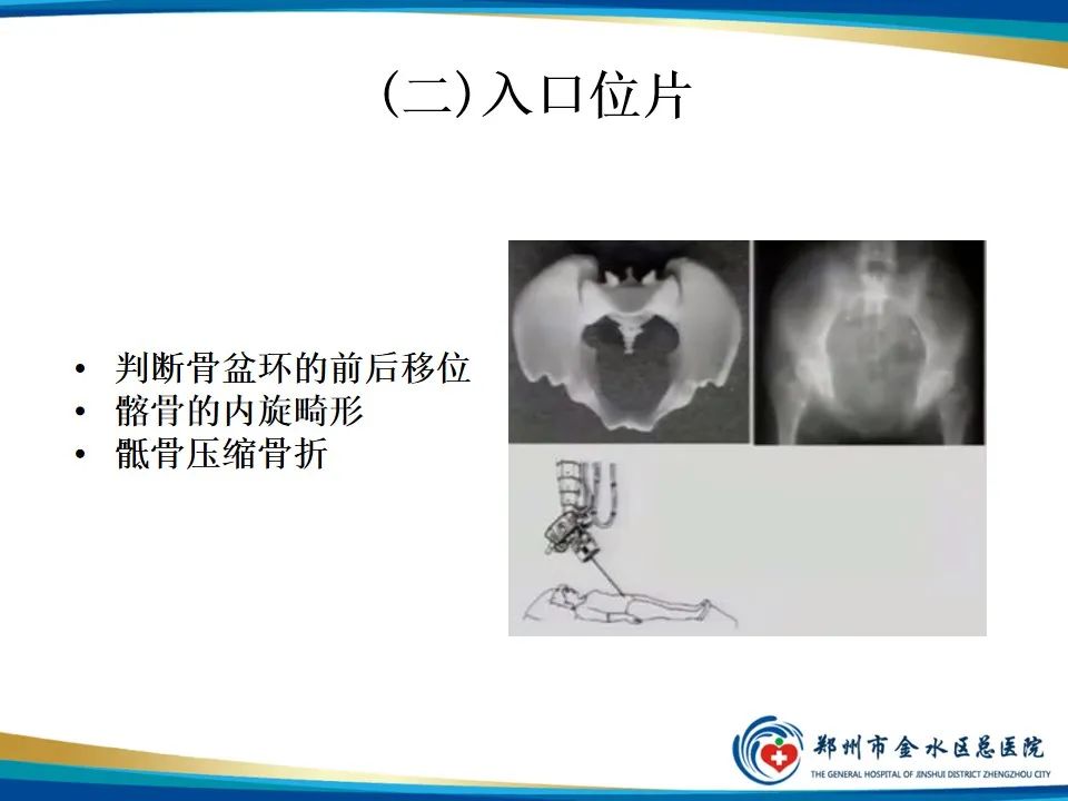 影像PPT - 【PPT】骨盆拍片技术与临床意义-10