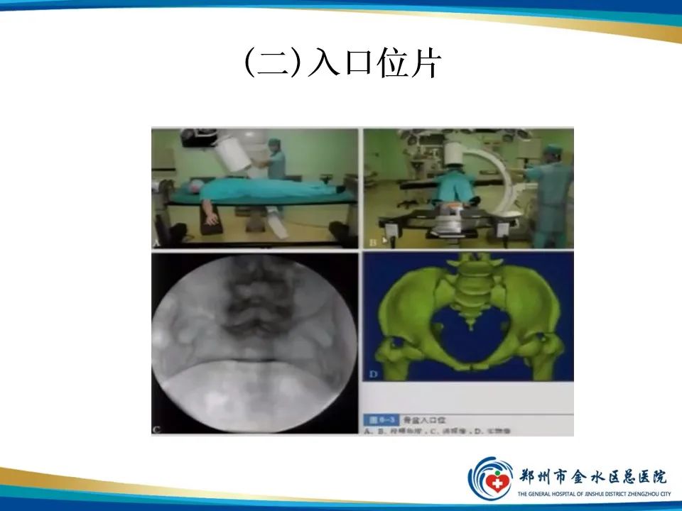 影像PPT - 【PPT】骨盆拍片技术与临床意义-11