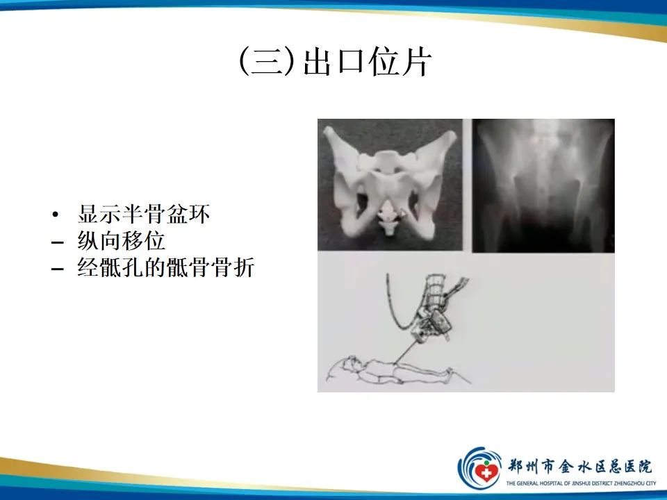 影像PPT - 【PPT】骨盆拍片技术与临床意义-14