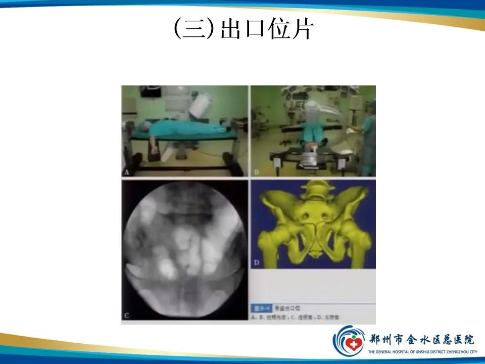 影像PPT - 【PPT】骨盆拍片技术与临床意义-15