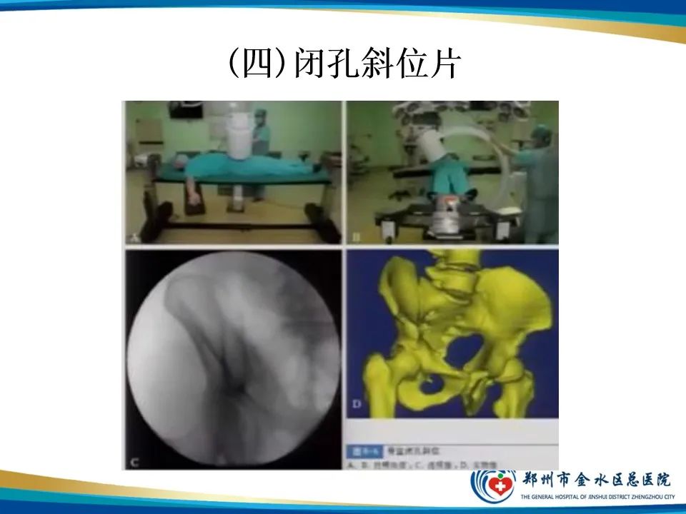 影像PPT - 【PPT】骨盆拍片技术与临床意义-19