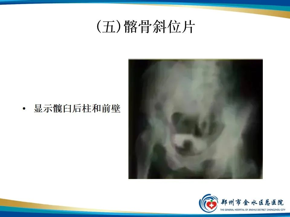 影像PPT - 【PPT】骨盆拍片技术与临床意义-22