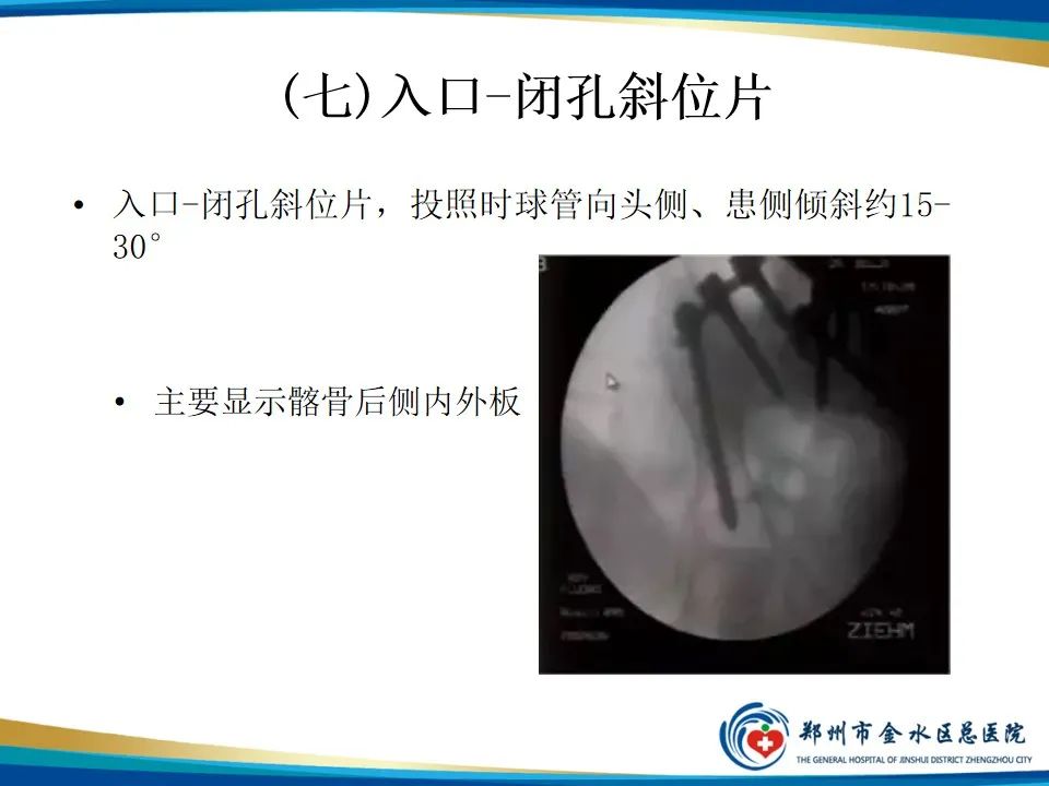 影像PPT - 【PPT】骨盆拍片技术与临床意义-26