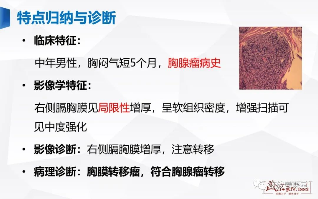 影像PPT - 【PPT】胸膜病变-6