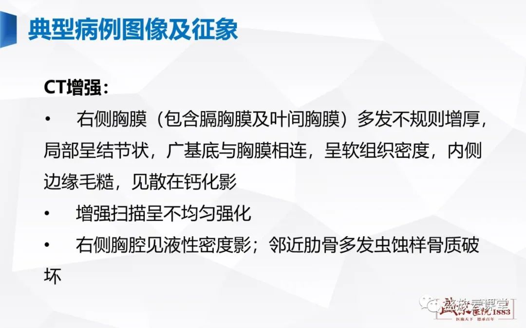 影像PPT - 【PPT】胸膜病变-9
