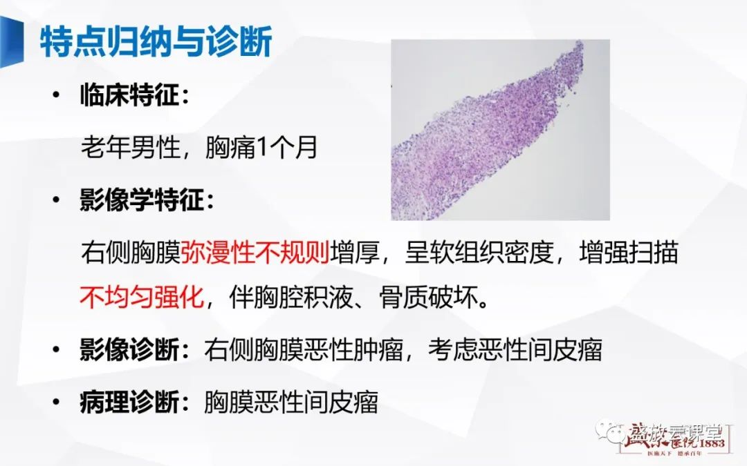 影像PPT - 【PPT】胸膜病变-11