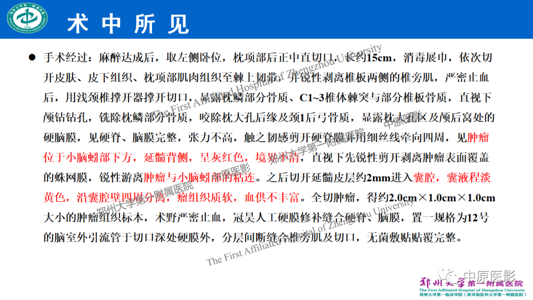 影像PPT - 【病例】枕骨大孔区脉络丛乳头状瘤1例MR影像-7