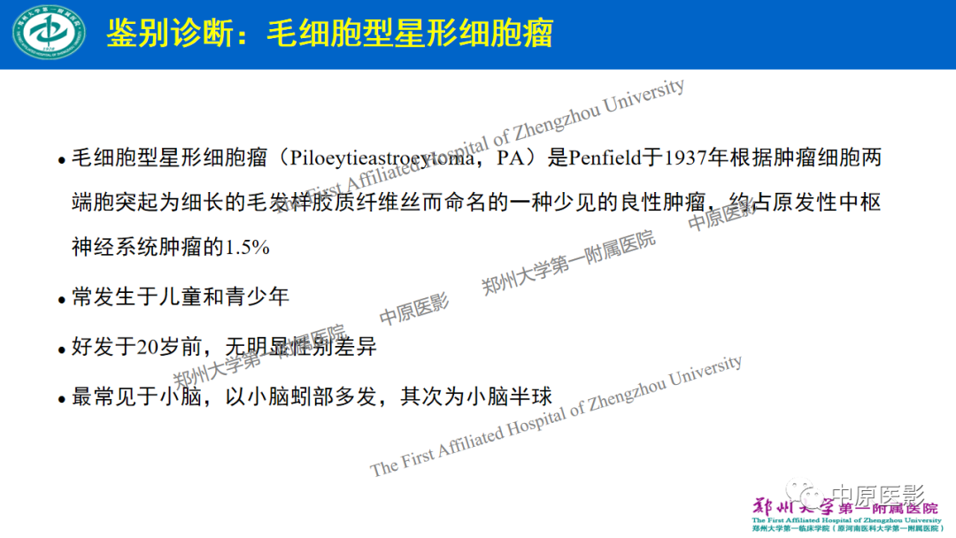 影像PPT - 【病例】枕骨大孔区脉络丛乳头状瘤1例MR影像-14