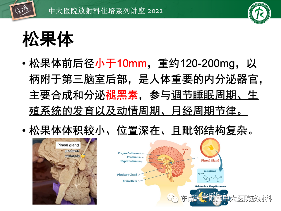 影像PPT - 【PPT】松果体区占位性病变的诊断思路-2