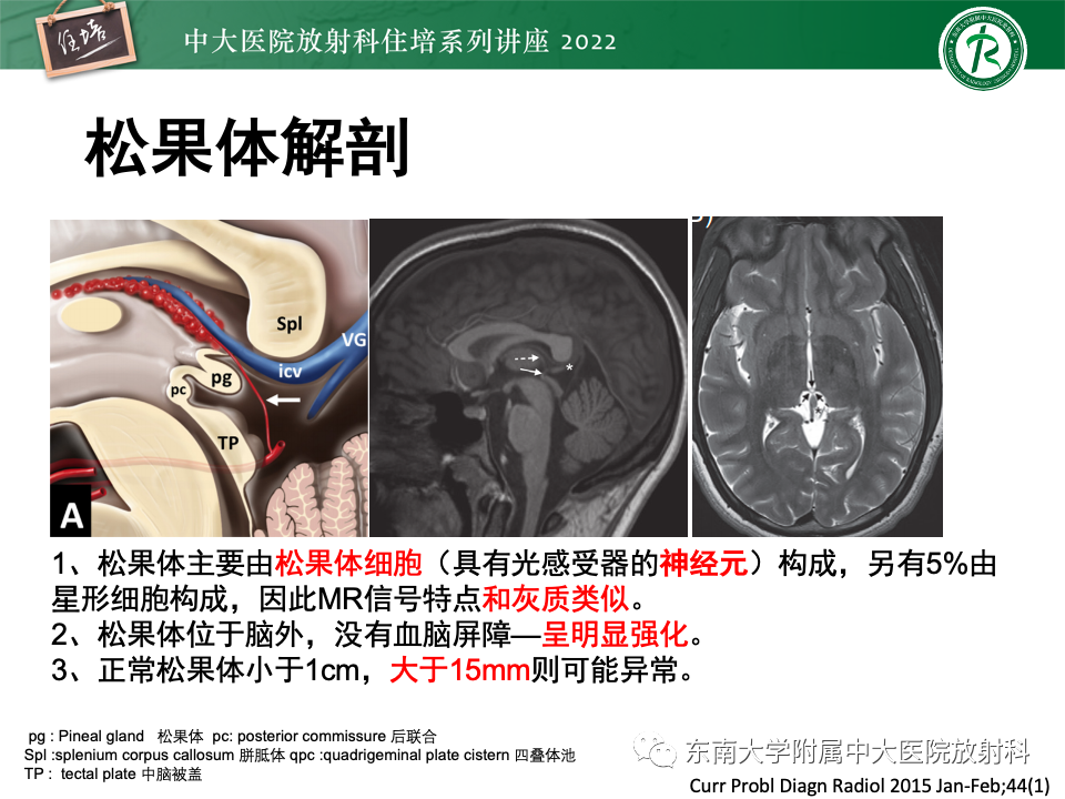 影像PPT - 【PPT】松果体区占位性病变的诊断思路-3
