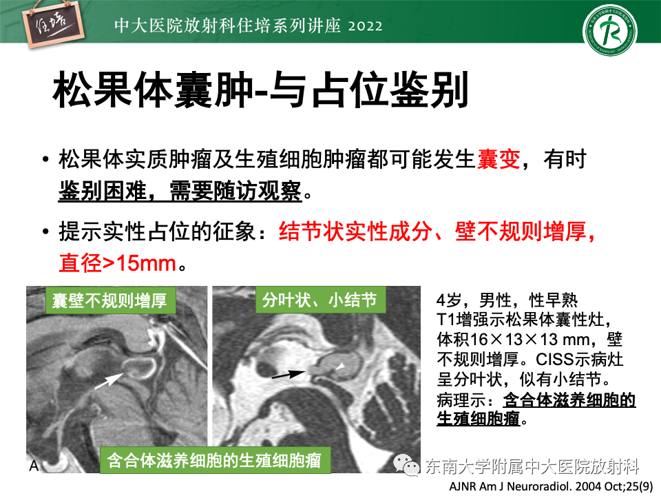 影像PPT - 【PPT】松果体区占位性病变的诊断思路-5
