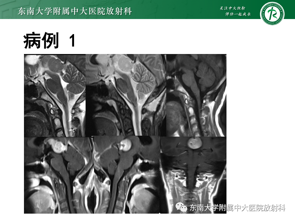 影像PPT - 【PPT】松果体区占位性病变的诊断思路-10
