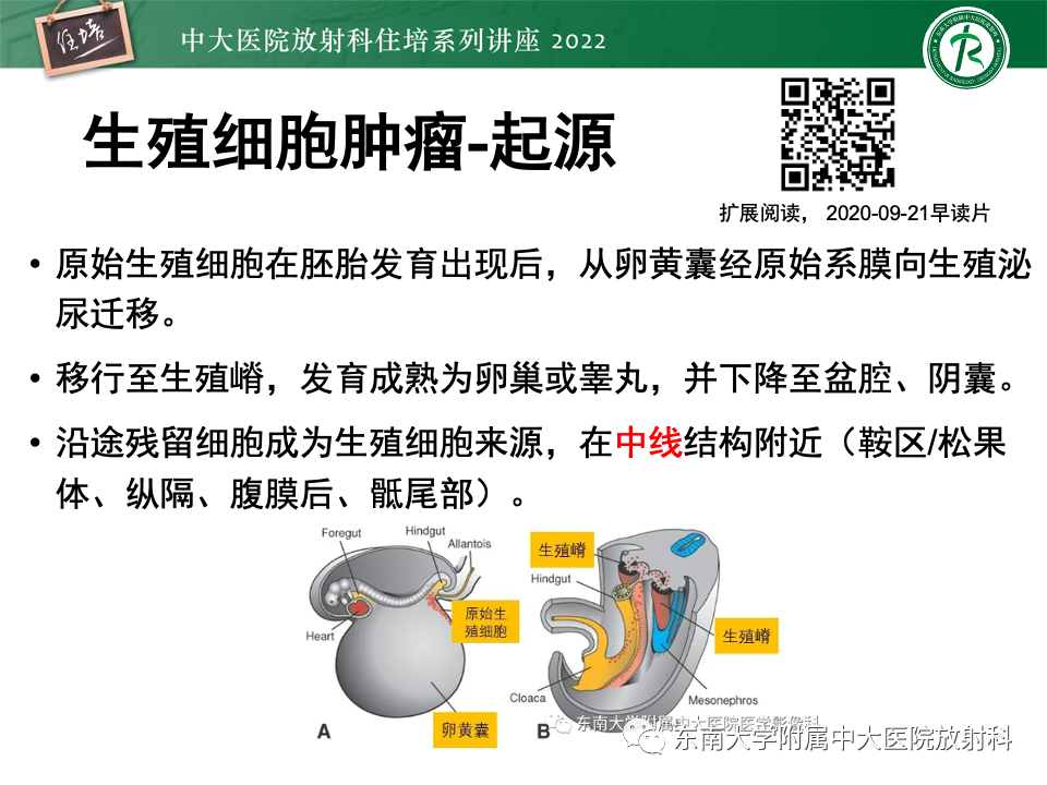 影像PPT - 【PPT】松果体区占位性病变的诊断思路-13