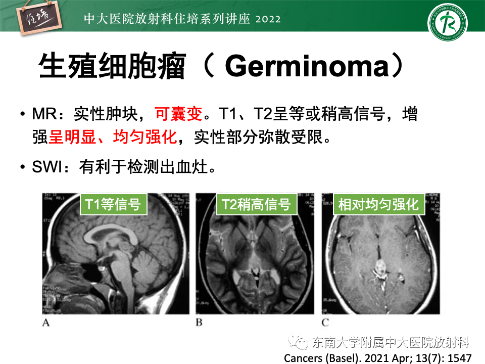 影像PPT - 【PPT】松果体区占位性病变的诊断思路-16