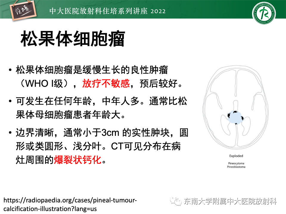 影像PPT - 【PPT】松果体区占位性病变的诊断思路-28