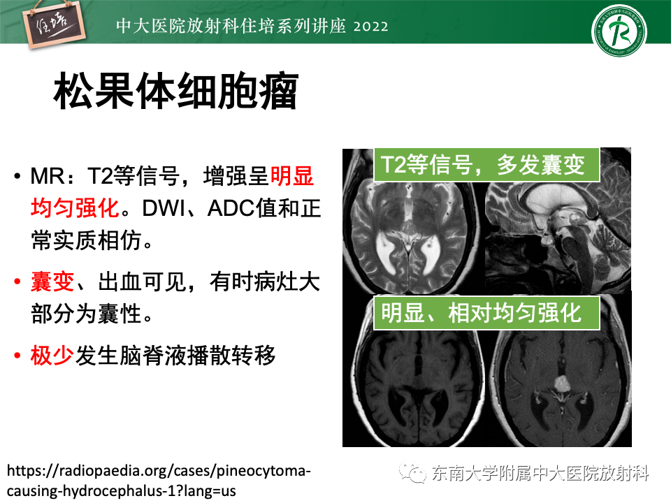 影像PPT - 【PPT】松果体区占位性病变的诊断思路-29