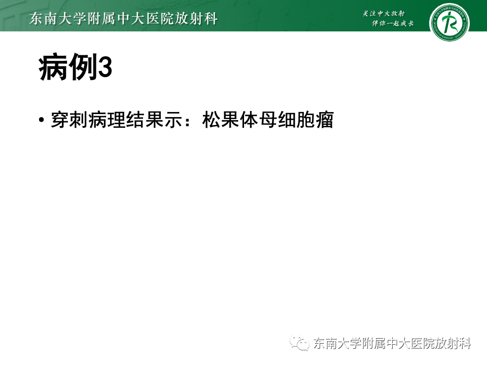 影像PPT - 【PPT】松果体区占位性病变的诊断思路-39