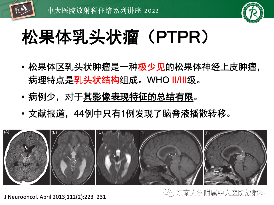 影像PPT - 【PPT】松果体区占位性病变的诊断思路-43