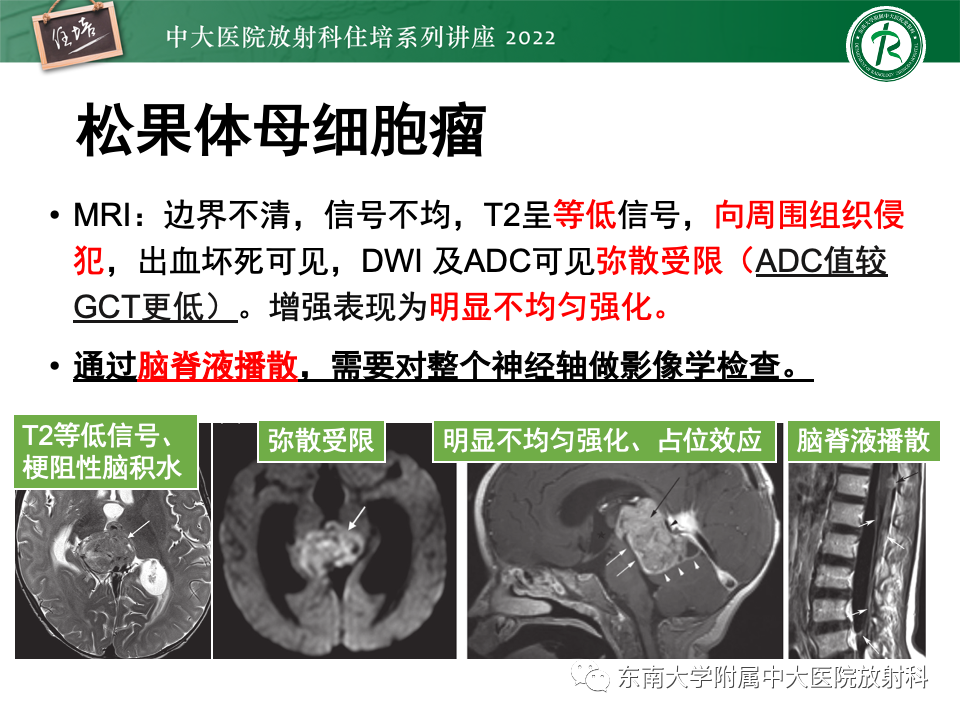 影像PPT - 【PPT】松果体区占位性病变的诊断思路-42