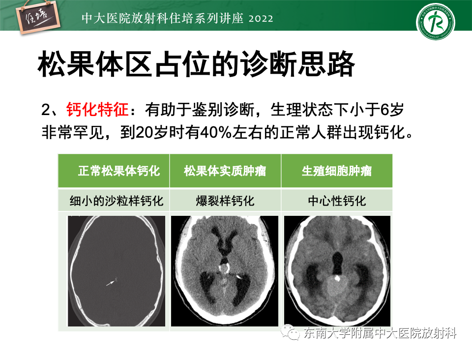 影像PPT - 【PPT】松果体区占位性病变的诊断思路-50