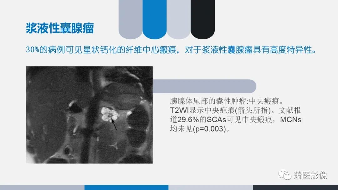 影像PPT - 【PPT】常见胰腺囊性肿瘤-6