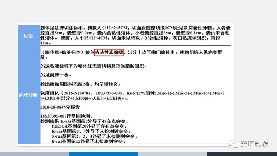 影像PPT - 【PPT】常见胰腺囊性肿瘤-49