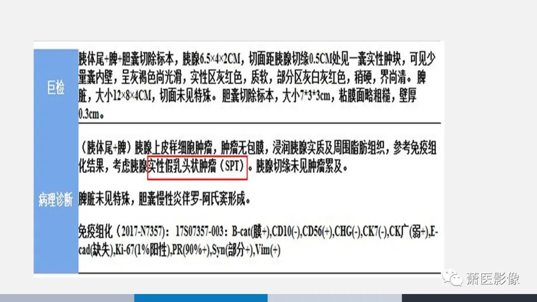 影像PPT - 【PPT】常见胰腺囊性肿瘤-55