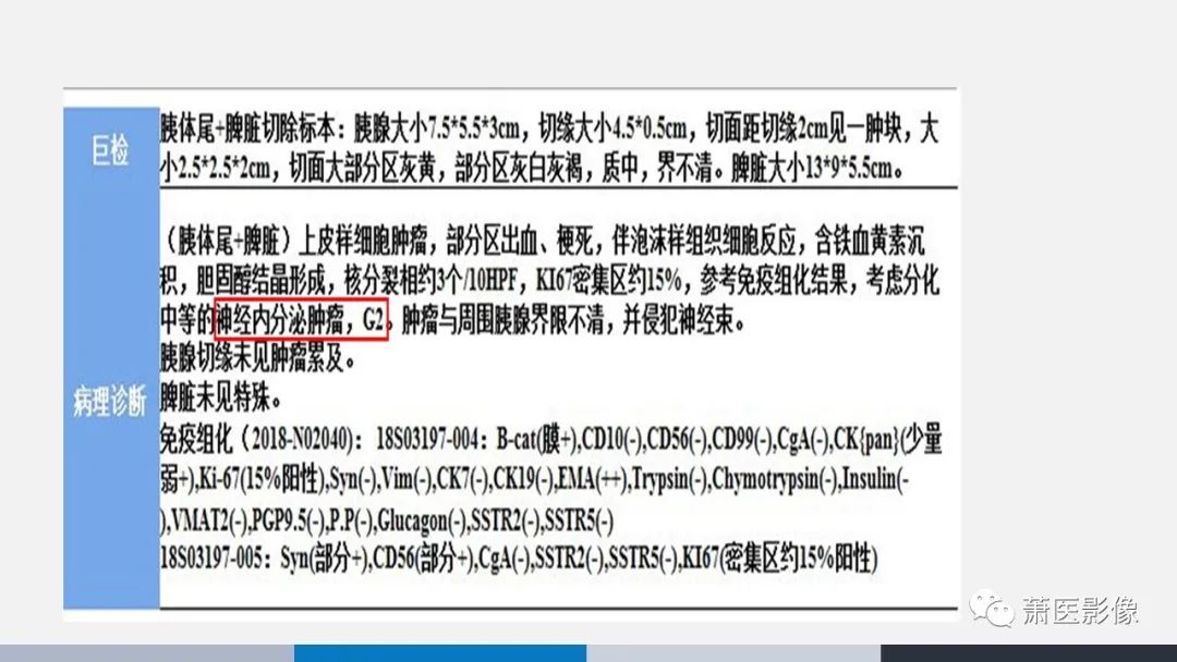 影像PPT - 【PPT】常见胰腺囊性肿瘤-57