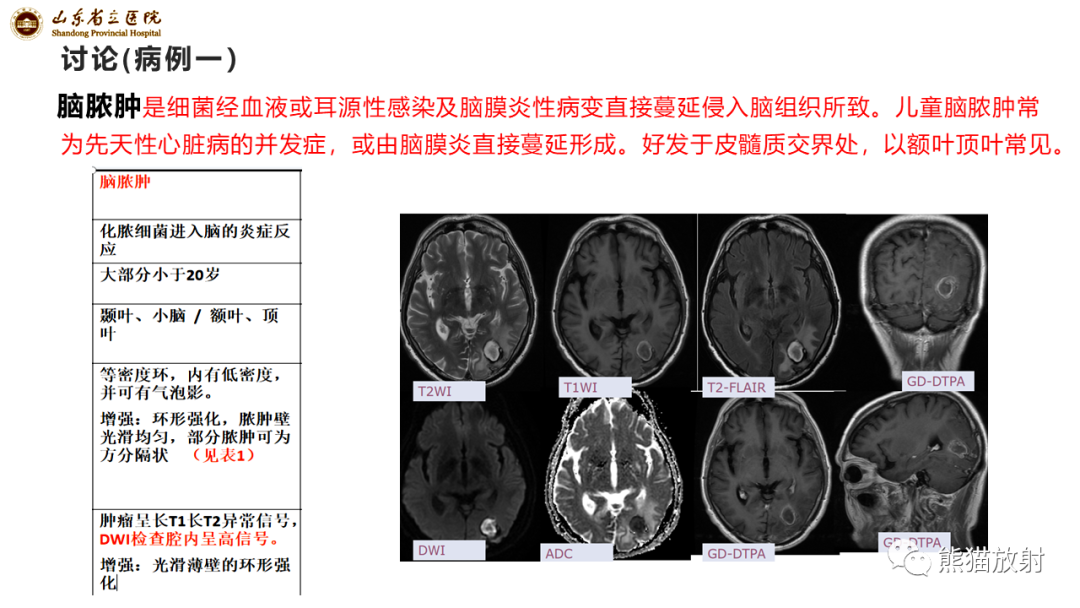 影像PPT - 【病例】炎性肉芽肿并脓肿形成 & 成熟性囊性畸胎瘤-13