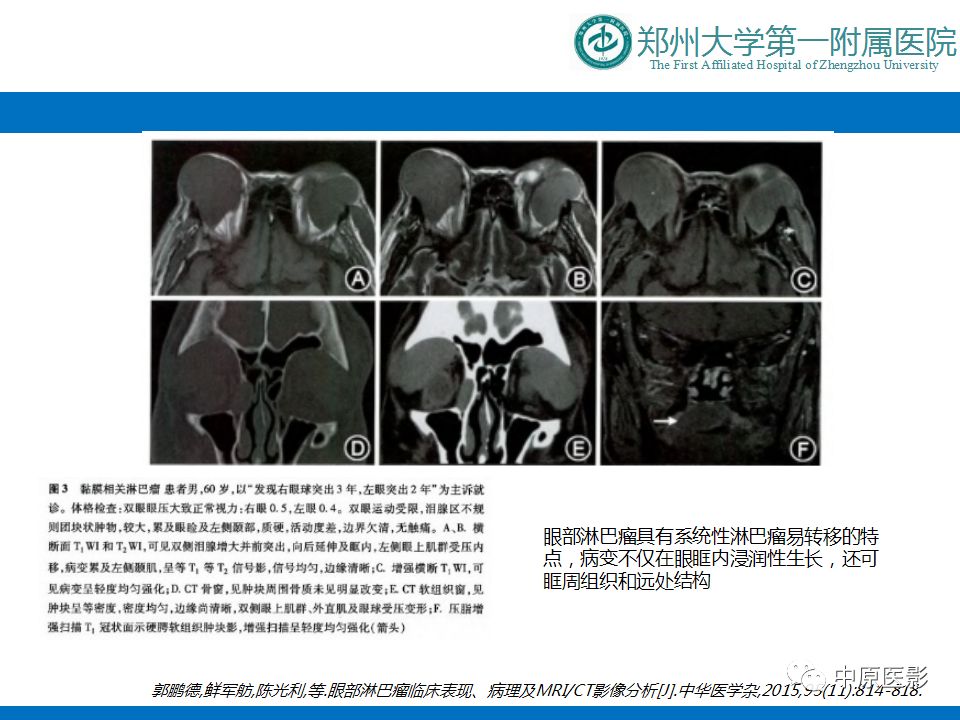 影像PPT - 【PPT】泪腺IgG4相关硬化性疾病1例MR-20