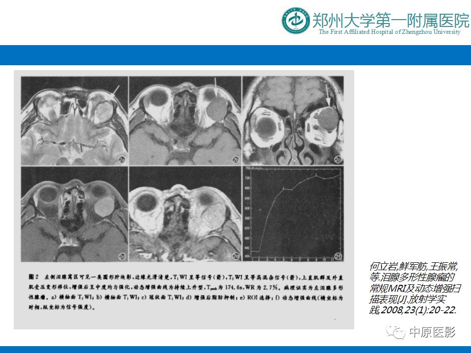 影像PPT - 【PPT】泪腺IgG4相关硬化性疾病1例MR-23