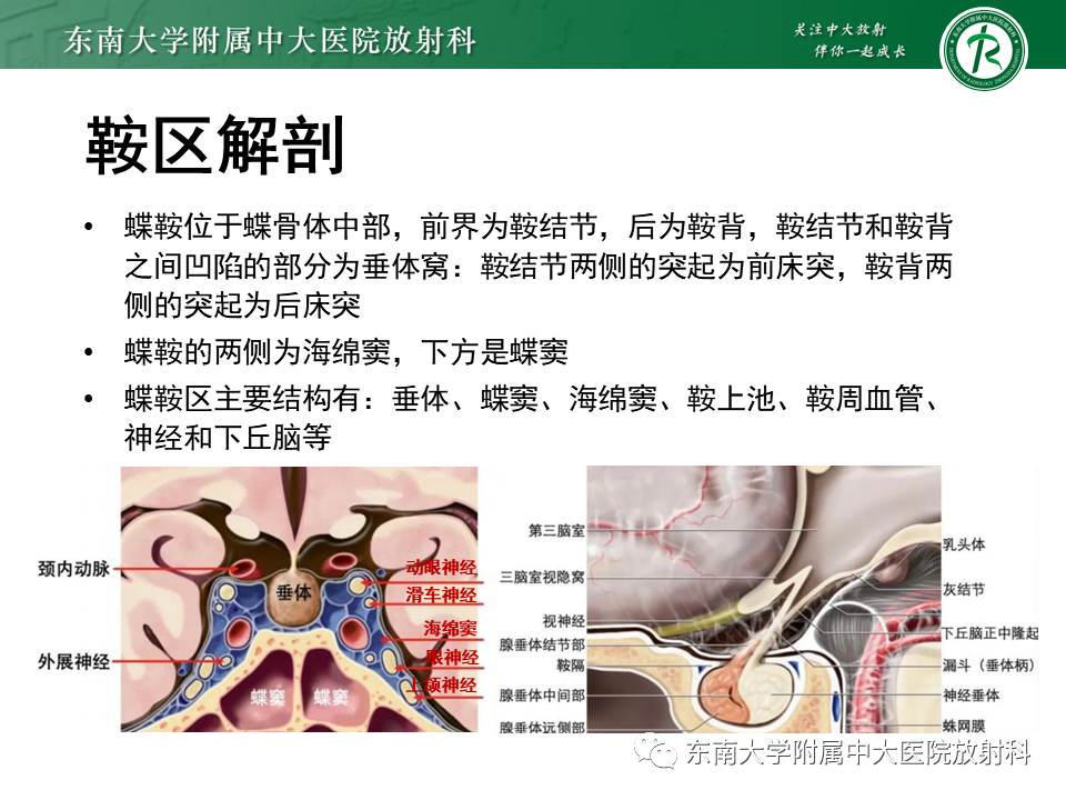 影像PPT - 【PPT】垂体Rathke囊肿-5