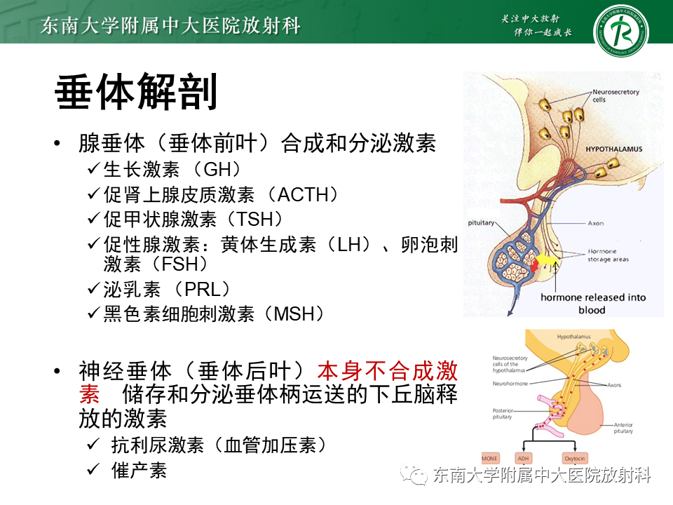 影像PPT - 【PPT】垂体Rathke囊肿-6