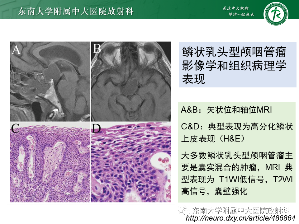 影像PPT - 【PPT】垂体Rathke囊肿-29