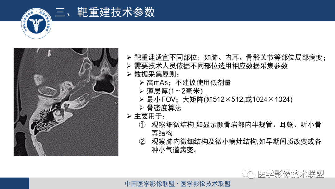 影像PPT - 【PPT】靶重建技术综述-6